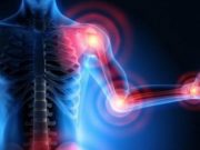 Какой коллаген для суставов более эффективен?