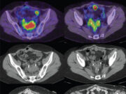 Вторичная профессиональная расшифровка результатов компьютерной томографии