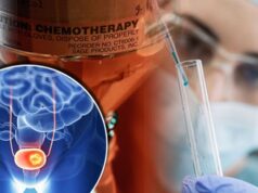 Рак мочевого пузыря: диагностика и лечение