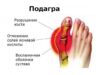 По каким причинам возникает заболевание подагра, ее развитие и лечение таблетками Колхицин Лирка