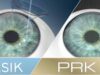 Выбор между LASIK и PRK: Какой метод лазерной коррекции выбрать