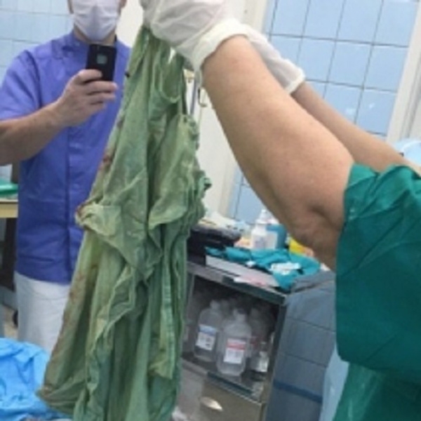 В Тюмени из носа женщины достали осколок зеркала, с которым она жила 25 лет