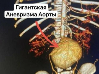 «Ребенка надо оперировать, но опыта такого в мире нет»: истории 4 чудесных спасений в СПбГПМУ
