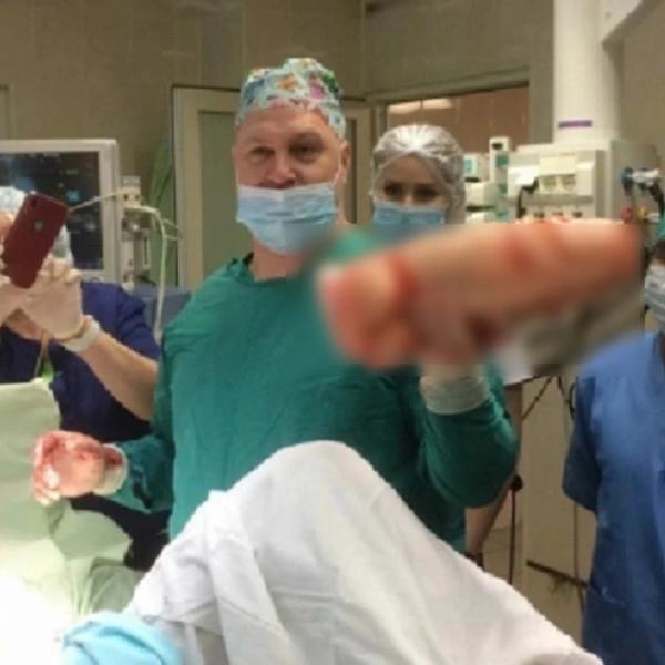 В Китае врачи удалили из кишечника мужчины зубную щетку, с которой он прожил полвека