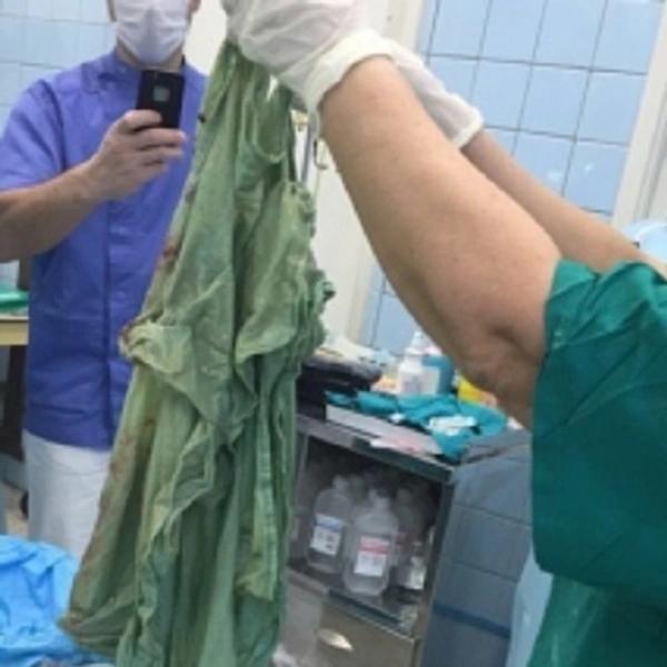 Тувинские врачи спасли мужчину, собравшего в желудке коллекцию из 27 зажигалок