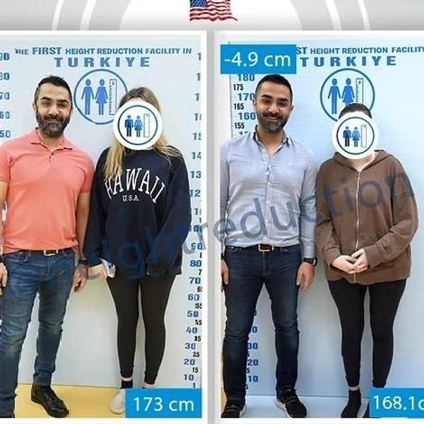 Модели больше не в моде? Зачем женщины делают операции по укорачиванию ног