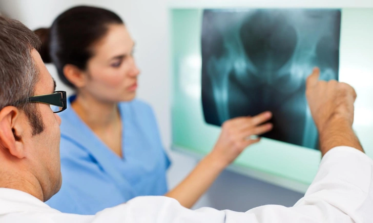 Даже забытую полвека назад иглу: врач Аляев рассказал, что можно увидеть на рентгене