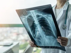 Первая в мире вакцина от рака легких входит в стадию клинических испытаний