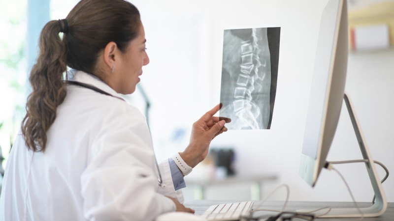 Саратовские ученые разработали приложение для диагностики остеохондроза