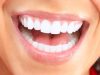 Белоснежная улыбка без страха: что стоит знать про отбеливание