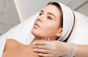 Нитевые методики омоложения: когда применяются и каких эффектов можно ожидать