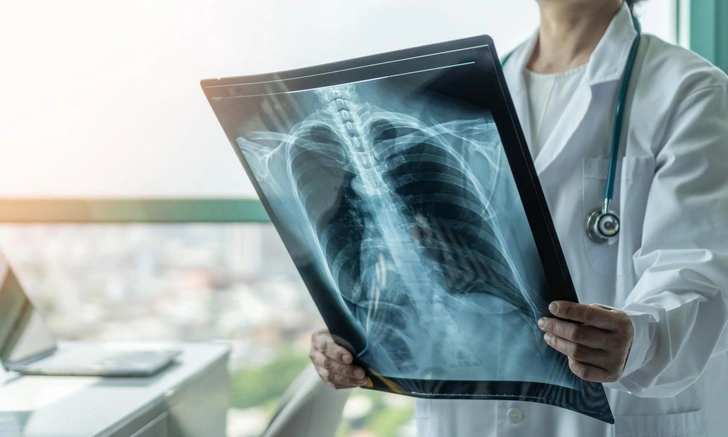 Мужчина курил 30 лет подряд и начал превращаться в «мумию»