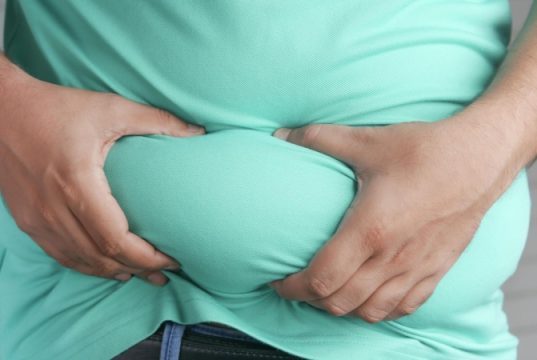 В Сеченовском университете выявили связь между ожирением и раком