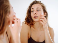 Акне и шрамы: лазеры и пилинги для устранения