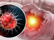 Ученые нашли путь к подавлению роста раковых клеток