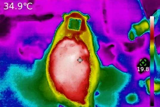 Ученые нашли 2 вида металлов в имплантатах, способные вызывать повреждения почек и печени