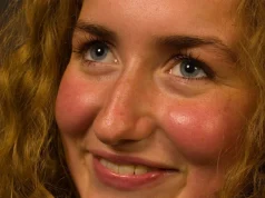 Сахарное лицо: как избыток сладостей и выпечки склеивает коллаген и «поджаривает» белки