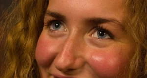 Сахарное лицо: как избыток сладостей и выпечки склеивает коллаген и «поджаривает» белки