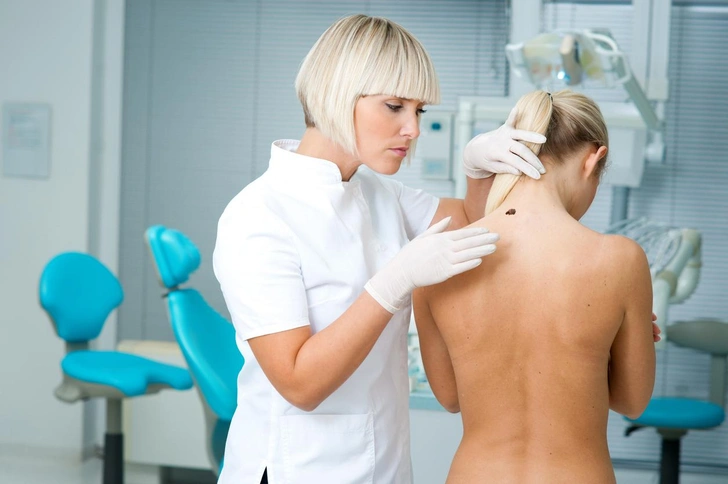 Заморозить, сжечь током и еще два способа удалить родинку — выбираем безопасный