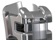 Как выбрать ортодонтическую продукцию Dental Progress: понятные шаги для врача и пациента