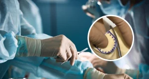 Не бык, не свинья, не металл: пациенту сшили сердечный клапан из собственных тканей сердца