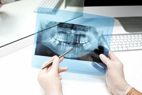 Можно ли использовать старый снимок зубов для нового плана лечения