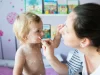 У 4-летней девочки случился инсульт, который спровоцировала ветрянка