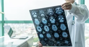 Ученые изобрели гель, создающий нейроны взамен утраченных при болезни Альцгеймера